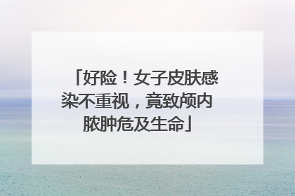 好险！女子皮肤感染不重视，竟致颅内脓肿危及生命